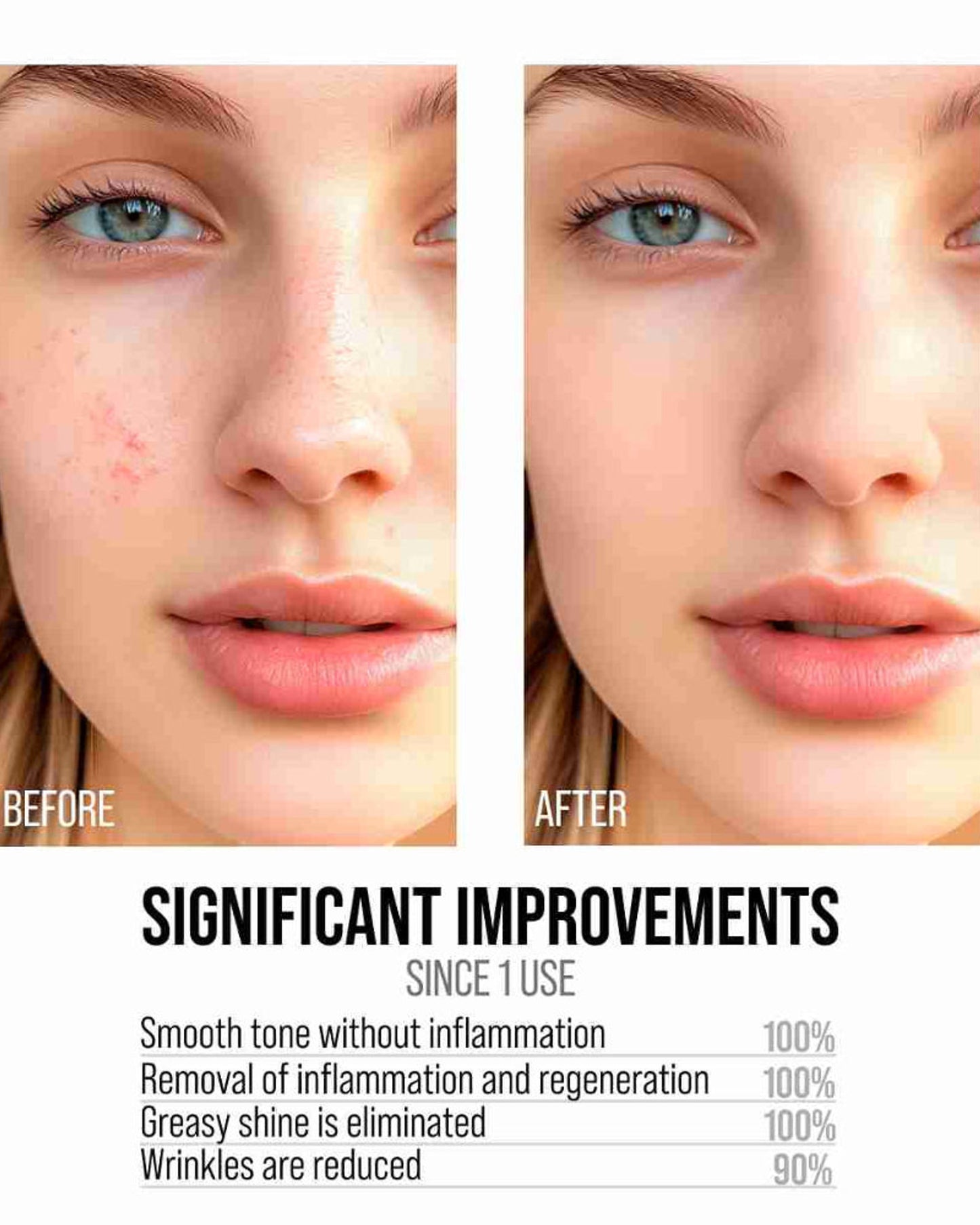 سيروم تقشير الوجه بحمض ألفا هيدروكسي/بيتا هيدروكسي من 7 أيام